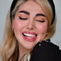 کامپوزیت دندان ۸۰ درصد تخیف