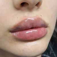 خدمات زیبایی پوست و مو با تخفیف ویژه|خدمات آرایشگری و زیبایی|قم, صفائیه|دیوار