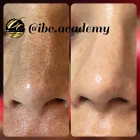 آموزش پوست شیشه ای( مجازی) محو پیسی|خدمات آموزشی|تهران, امیرآباد|دیوار