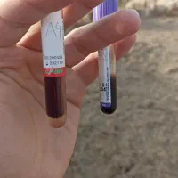 ونوجکت، سرسوزن و تجهیزات خونگیری|پزشکی|اردبیل, |دیوار