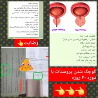 برطرف شدن مشکلات کلیه و پروستات
