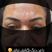 ژل وبوتاکس|خدمات آرایشگری و زیبایی|اهواز, کوی مندلی(سه راه خرمشهر)|دیوار