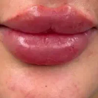 مدل ژل لب روسی۳۵۰ونخ لیفت۷۰۰وو فول فیس وژل بادی۵۰۰|خدمات آرایشگری و زیبایی|تهران, آهنگ|دیوار