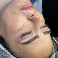 جراحی و زیبایی صورت