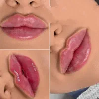 فیلر لب وبوتاکس|خدمات آرایشگری و زیبایی|مشهد, هفت تیر (آب و برق)|دیوار