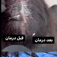 اسکالپ اسکراب (پاکسازی کف سر)،واحیا و ضخیم سازی مو|خدمات آرایشگری و زیبایی|شیراز, خلدبرین|دیوار