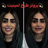 دندانسازی مصنوعی دندان مصنوعی با کیفیت و زیبا|خدمات آرایشگری و زیبایی|تبریز, |دیوار