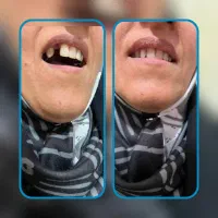 دندانپزشکی،دندانسازی|خدمات آرایشگری و زیبایی|دشتابی, |دیوار