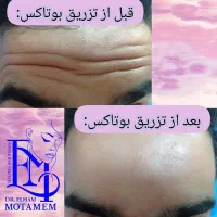 مطب پوست،مو،زیبایی دکتر الهام متمم