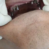 کلینیک تخصصی ایمپلنت با اقساط بلندمدت|خدمات آرایشگری و زیبایی|تهران, قیطریه|دیوار