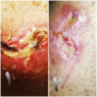 خدمات پرستاری و تزریقات در منزل محمودآباد|خدمات آرایشگری و زیبایی|محمودآباد, |دیوار
