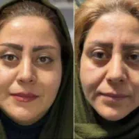 دفترپخش کرم ضد چروک گاتیو بیوممتیک (۵کاره)