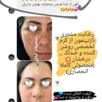 کرم ضدلک و روشن کننده درخشان(بدون بازگشت)|آرایشی، بهداشتی، درمانی|شیراز, قصرالدشت|دیوار