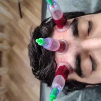 حجامت، درمان چسبندگی عصب دست، کبد چرب