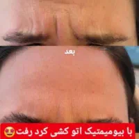 کرم چین و چروک|آرایشی، بهداشتی، درمانی|آباده, |دیوار