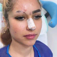 مدل کاشت ابرو|خدمات آرایشگری و زیبایی|شیراز, معالی‌آباد|دیوار