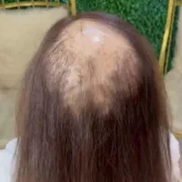 اکستنشن موطبیعی نصب وسرچسب وریمو آف ویژه باضمانت|خدمات آرایشگری و زیبایی|تهران, ستارخان|دیوار
