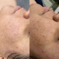 اصلاح صورت ۴۰ تومن|خدمات آرایشگری و زیبایی|مشهد, کارگران|دیوار