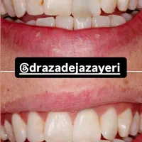 تخفیف خدمات دندانپزشکی