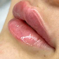 جشنواره تخفیف ویژه فیلربوتاکس انزیم وقت فوری|خدمات آرایشگری و زیبایی|کرج, گوهردشت|دیوار