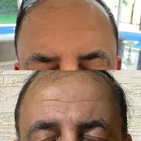 خدمات و آموزش تخصصی پوست و زیبایی|خدمات آرایشگری و زیبایی|شیراز, ارم|دیوار