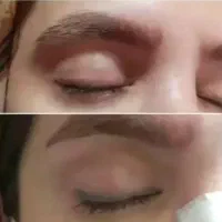 پاک کردن تتو قدیمی و خدمات زیبایی