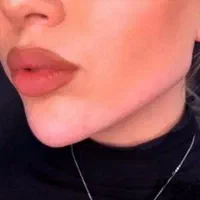 بوتاکس وتزریق ژل لیفت نخ بلفاروساکشن وکاشت مو|خدمات آرایشگری و زیبایی|مشهد, آزادشهر|دیوار