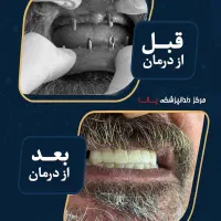 مرکز دندانپزشکی پانا ( ایمپلنت و زیبایی )