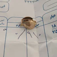گوشوار صدفی نوزادی ۹۱۰سوت