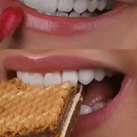 خدمات تخصصی زیبایی دندان|خدمات آرایشگری و زیبایی|بندر کنگان, |دیوار