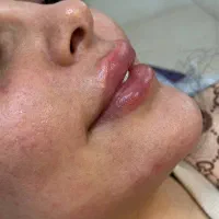 کلینیک زیبایی پوست و مو مایا|خدمات آرایشگری و زیبایی|ماهدشت, |دیوار