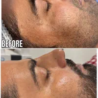 مدل پاکسازی صورت و بدن(خانم و اقا)باهم یا جدا|خدمات آرایشگری و زیبایی|مشهد, کوثر|دیوار