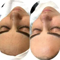 فیشیال تخصصی پوست رها