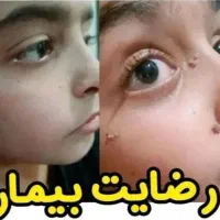 درمان ریشه ای تبخال و زگیل تناسلی با گیاهان دارویی|خدمات آرایشگری و زیبایی|اهواز, گلستان|دیوار