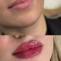 ژل اودری کره ای اصل سی سی 750