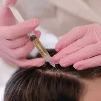 پی آر پی حجامت مزوژل بادکش امبدینگ طب سوزنی hpv