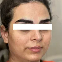 مدل کاشت ابرو