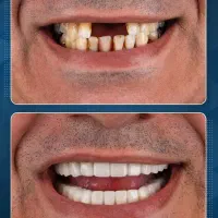 کلینیک تخصصی ایمپلنت دیجیتال آرمو|خدمات آرایشگری و زیبایی|شیراز, فرهنگ شهر|دیوار