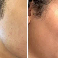 تخصصی پوست و مو و لیزر|خدمات آرایشگری و زیبایی|یاسوج, |دیوار