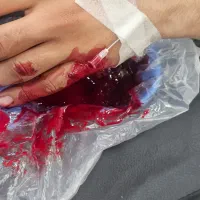 زیبایی درمانی|خدمات آرایشگری و زیبایی|بوشهر, |دیوار