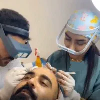 کاشت مو توسط تکنسین شیرازی در یزد