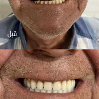 دندانسازی محلات|خدمات آرایشگری و زیبایی|محلات, |دیوار