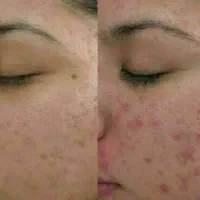 خارمریم معجزه ی پاکسازی پوست|آرایشی، بهداشتی، درمانی|اهواز, کوی فرهنگیان ۲|دیوار
