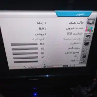 ال سی دی ایکس ویژن|تلویزیون و پروژکتور|بروجرد, |دیوار