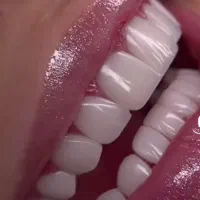 دندون پزشکی|خدمات آرایشگری و زیبایی|خرم‌آباد, |دیوار