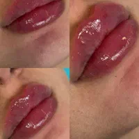 جشنواره افتتاحیه مطب پزشک پوست، مو، زیبایی در سیدی