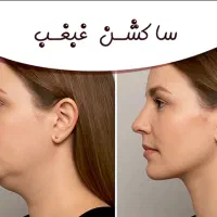 عمل زیبایی|خدمات آرایشگری و زیبایی|تهران, زعفرانیه|دیوار