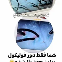 آموزش و خدمات اسکراپ اسکالپ مو سر  فقط ۶۰۰ تخصصی|خدمات آرایشگری و زیبایی|مشهد, کوثر|دیوار