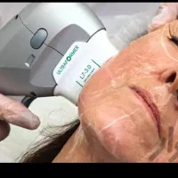 جوانسازی در یک جلسه با هایفو تراپی ۸۵۰ هزار ت