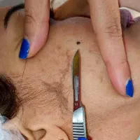 فشیال تخصصی+ اصلاح با بند + درماپلینگ + ابرو  ۳۵۰|خدمات آرایشگری و زیبایی|زاهدان, |دیوار